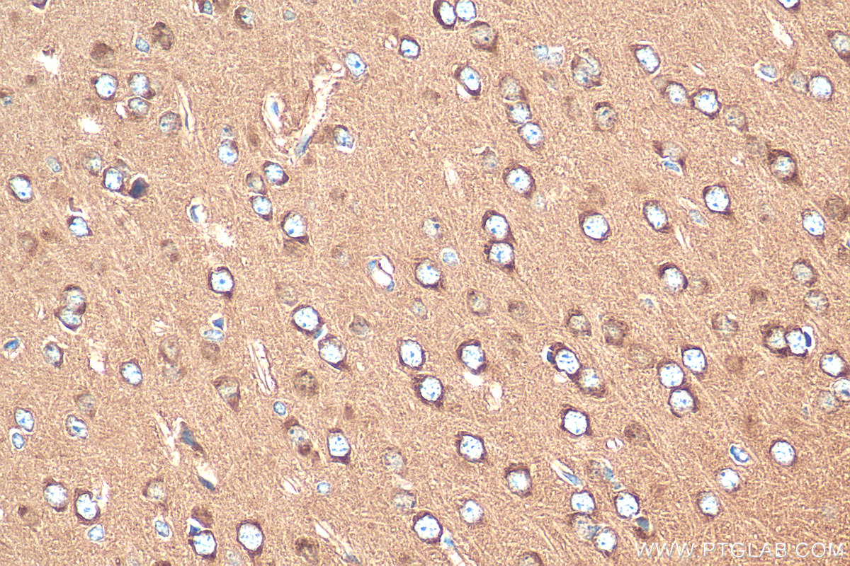 IHC staining of mouse brain using 24807-1-AP (same clone as 24807-1-PBS)