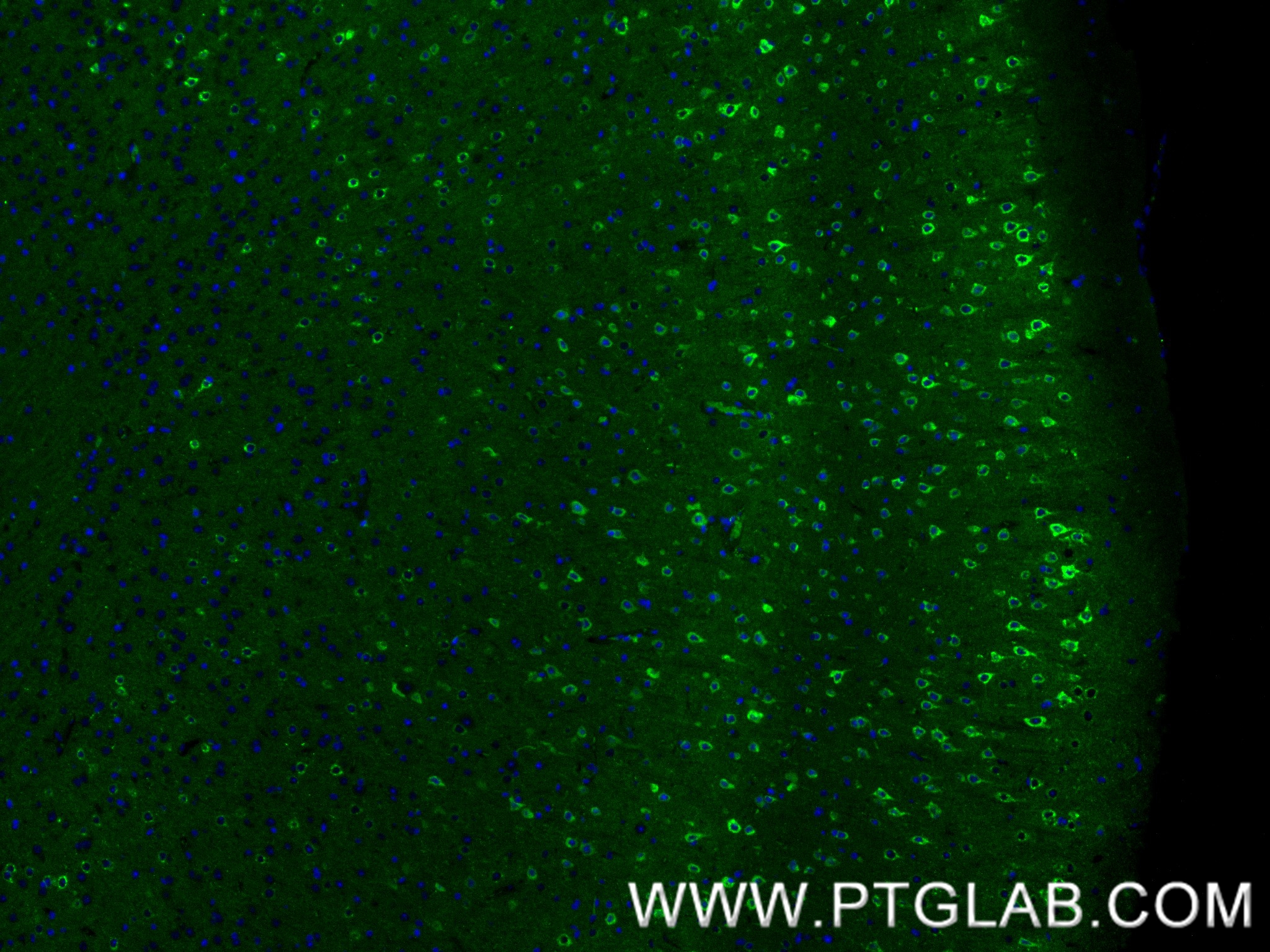 IF Staining of mouse brain using 85994-1-RR