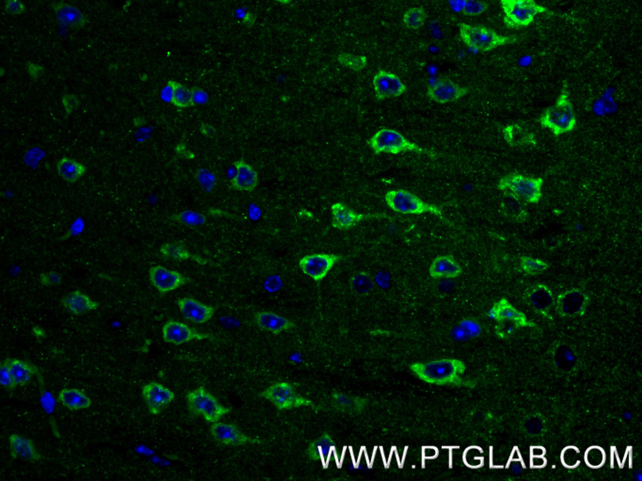 IF Staining of mouse brain using 85994-1-RR