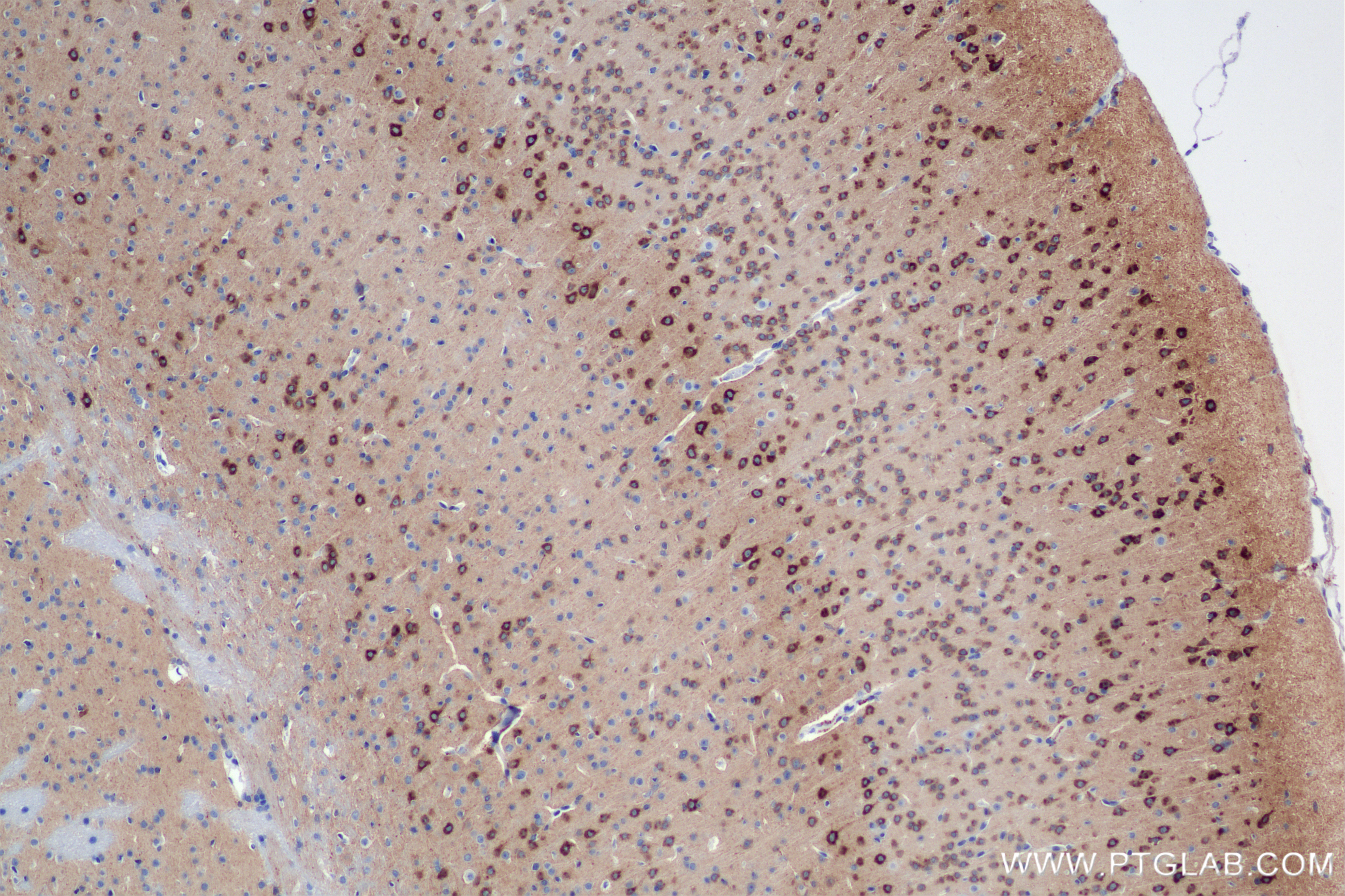 IHC staining of mouse brain using 85994-1-RR