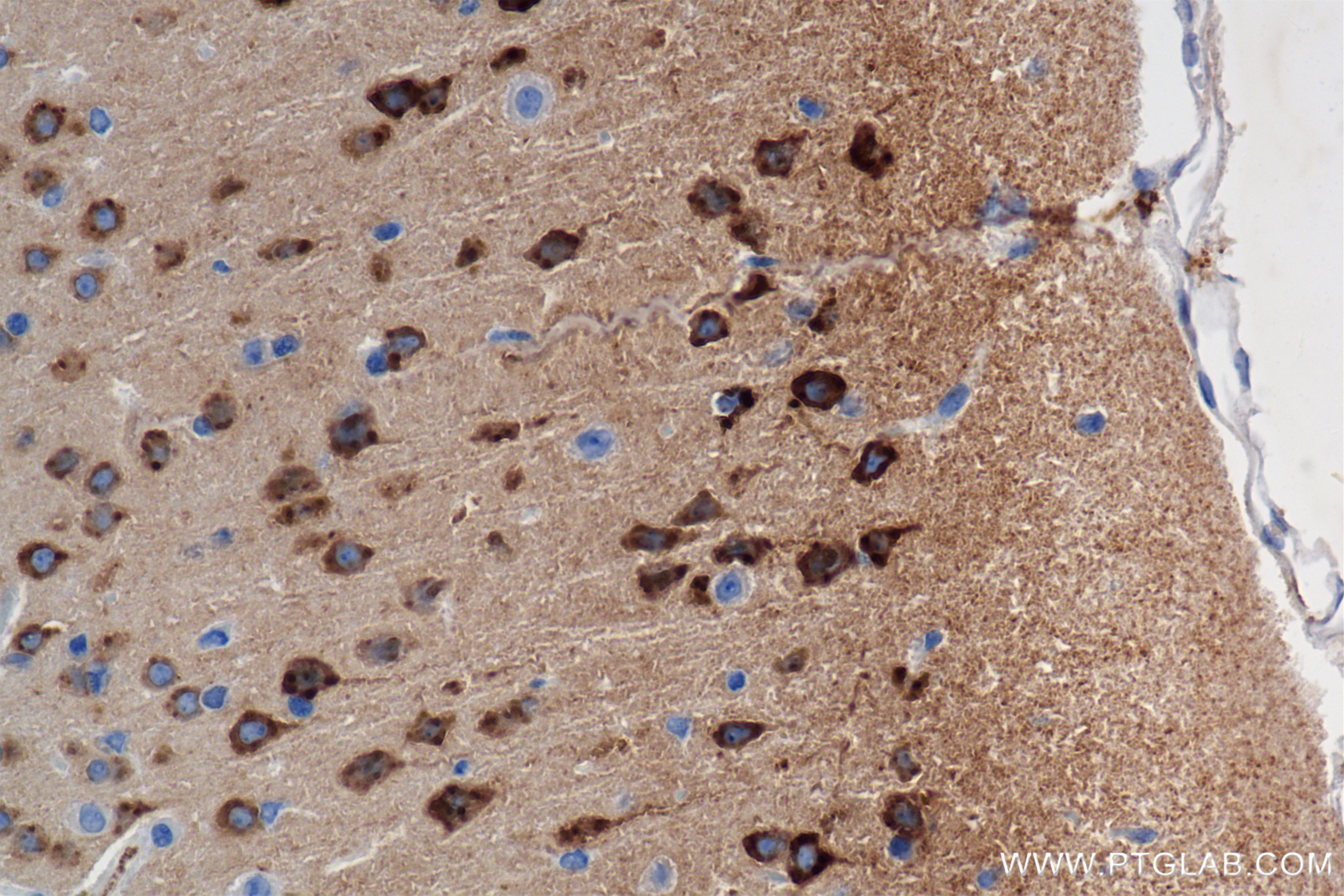 IHC staining of mouse brain using 85994-1-RR