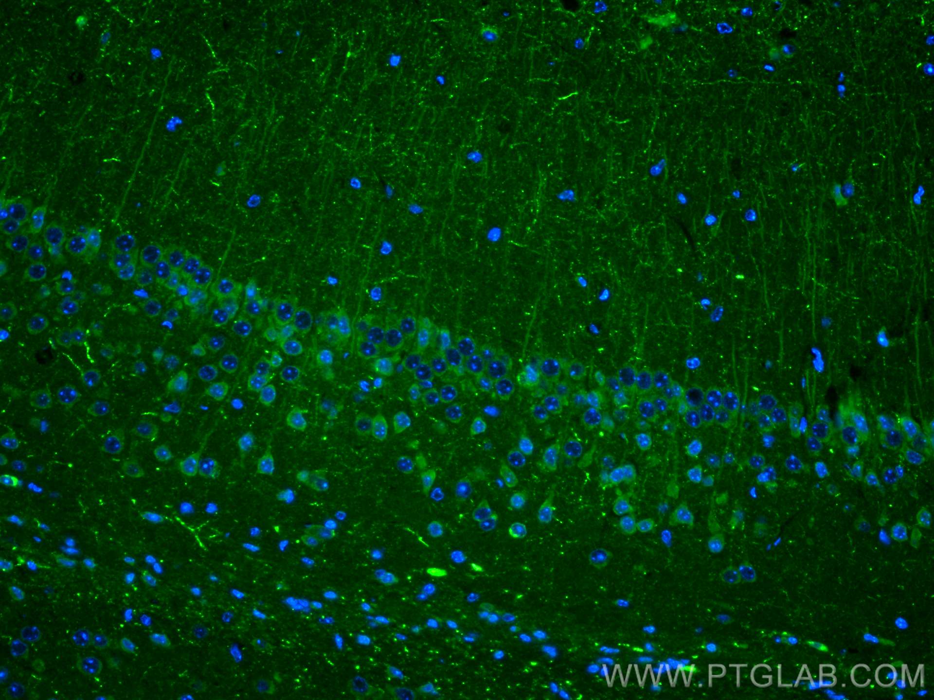 IF Staining of mouse brain using 12833-1-AP