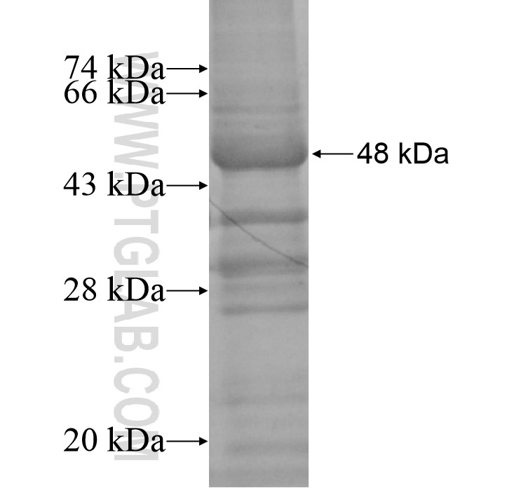 NPY2R fusion protein Ag13684 SDS-PAGE NPY2R fusion protein Ag13684 SDS-PAGE