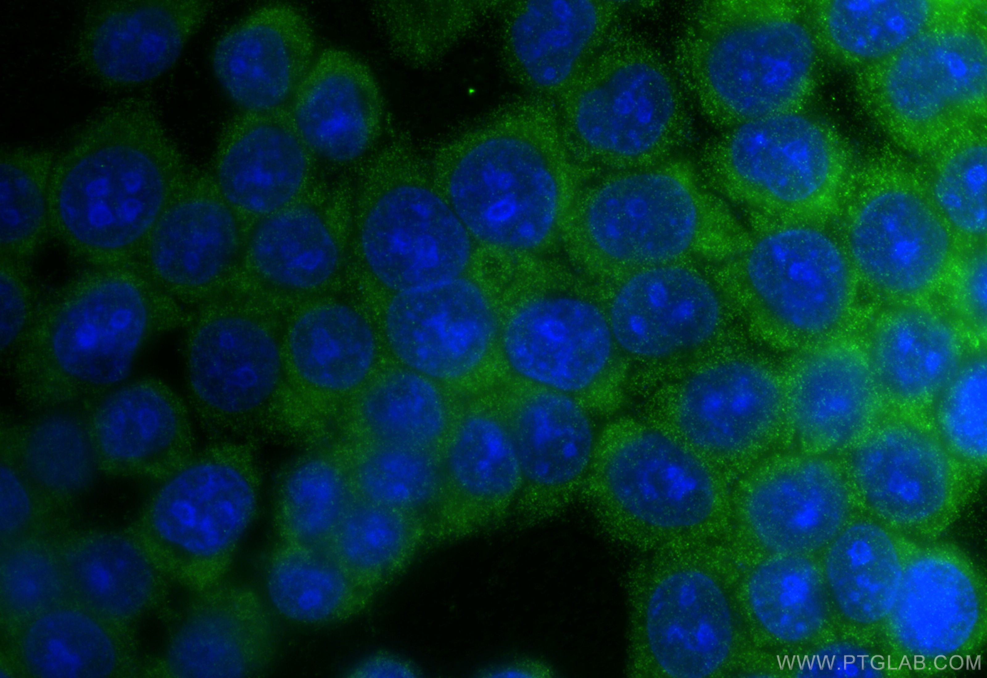 IF Staining of BxPC-3 using 30848-1-AP