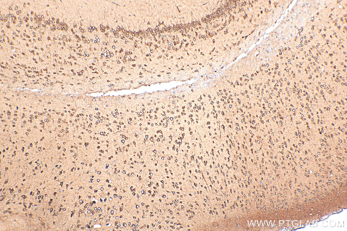 IHC staining of mouse brain using 30848-1-AP