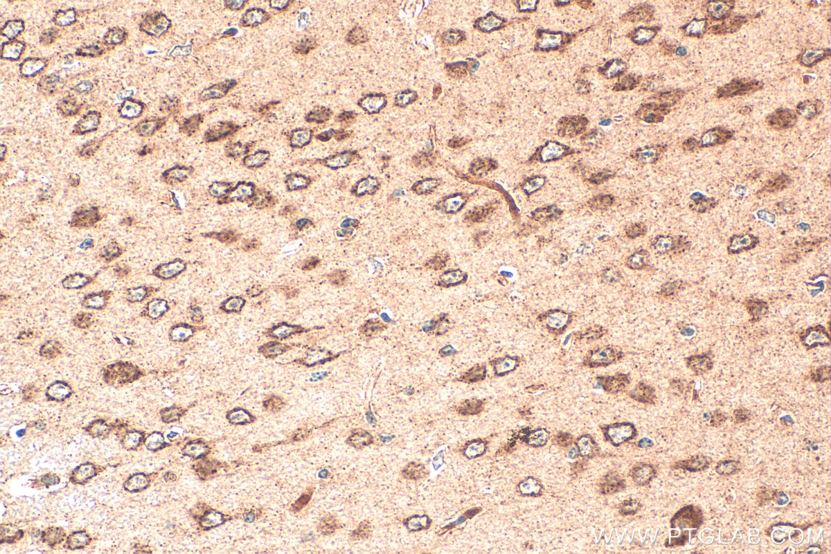 IHC staining of mouse brain using 30848-1-AP