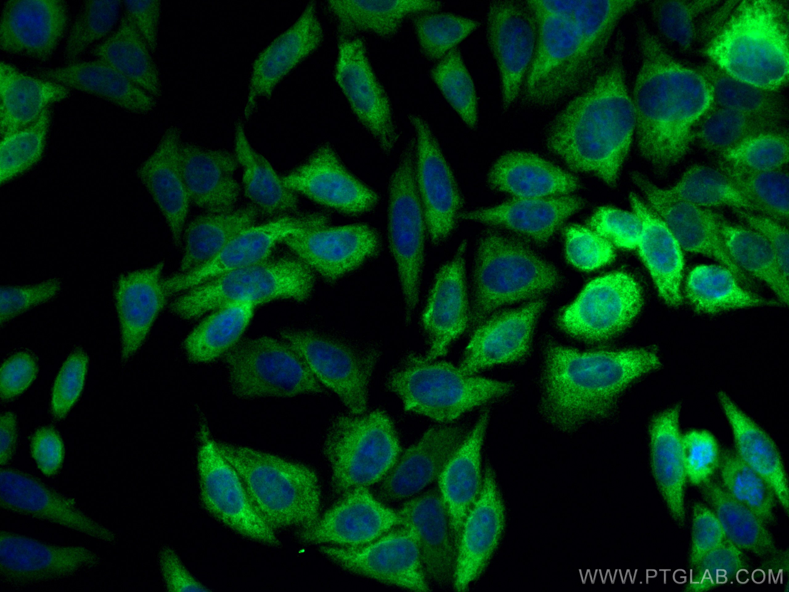 IF Staining of HepG2 using 11451-1-AP