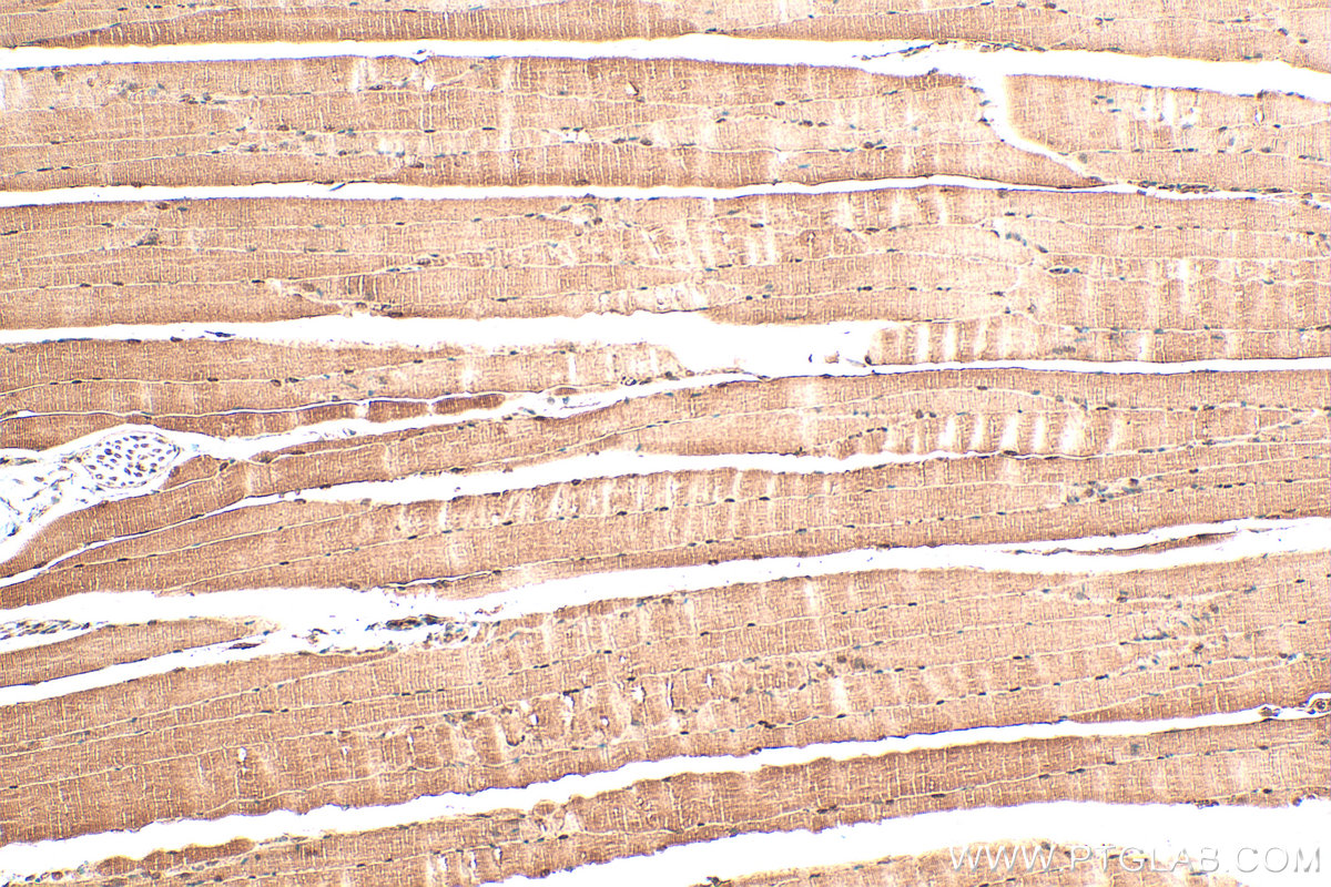IHC staining of mouse skeletal muscle using 14506-1-AP