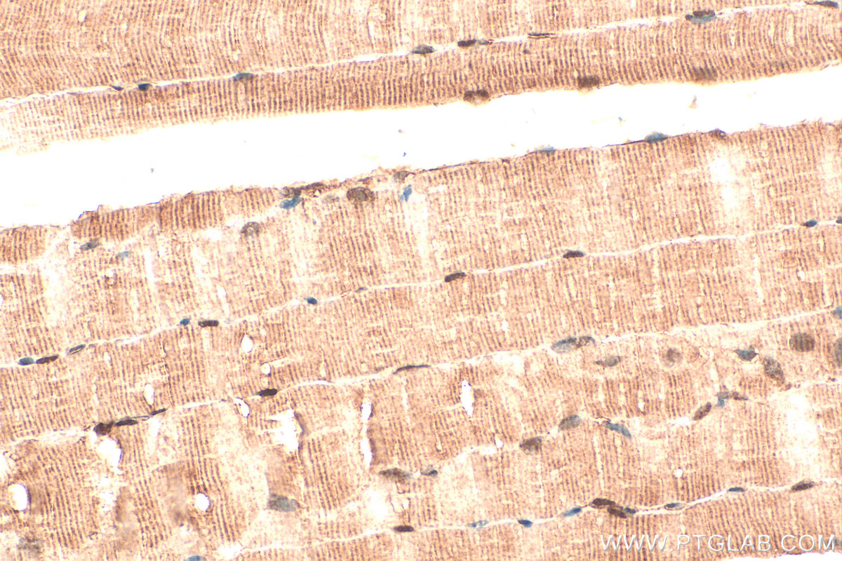 IHC staining of mouse skeletal muscle using 14506-1-AP