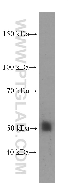 WB analysis of human liver using 60345-1-Ig (same clone as 60345-1-PBS)