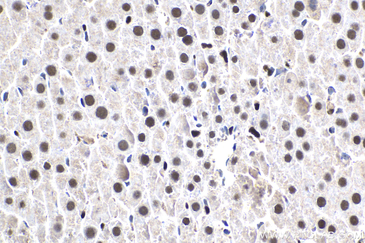 IHC staining of rat liver using 14351-1-AP