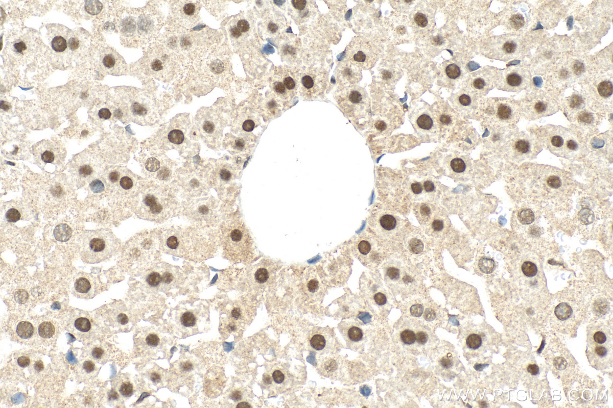IHC staining of mouse liver using 14351-1-AP