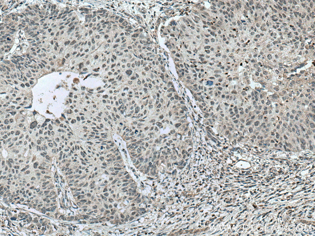 IHC staining of human kidney using 25055-1-AP