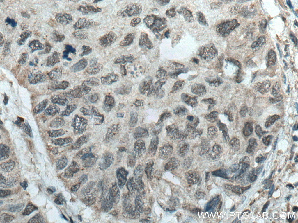 IHC staining of human kidney using 25055-1-AP