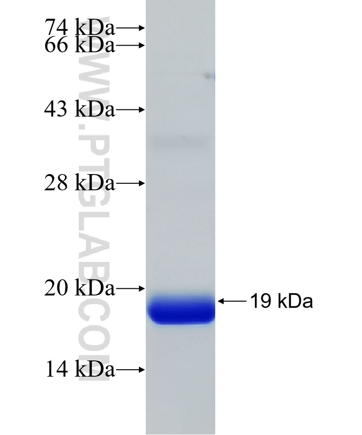 NR1H4 fusion protein Ag21878 SDS-PAGE