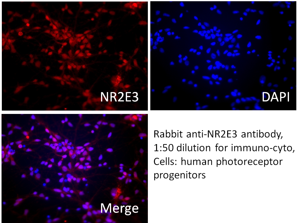 IF Staining of photoreceptor progenitor cells using 14246-1-AP (same clone as 14246-1-PBS)