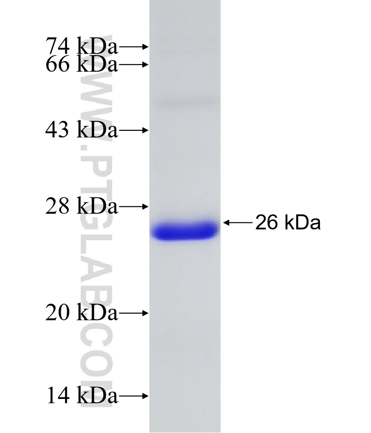 NR2E3 fusion protein Ag31272 SDS-PAGE NR2E3 fusion protein Ag31272 SDS-PAGE