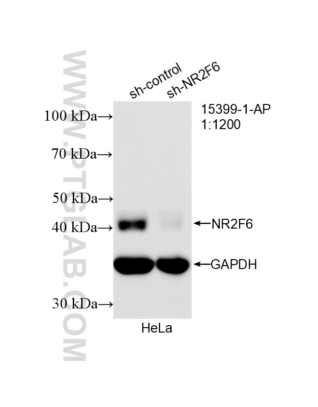 WB analysis of HeLa using 15399-1-AP WB analysis of HeLa using 15399-1-AP