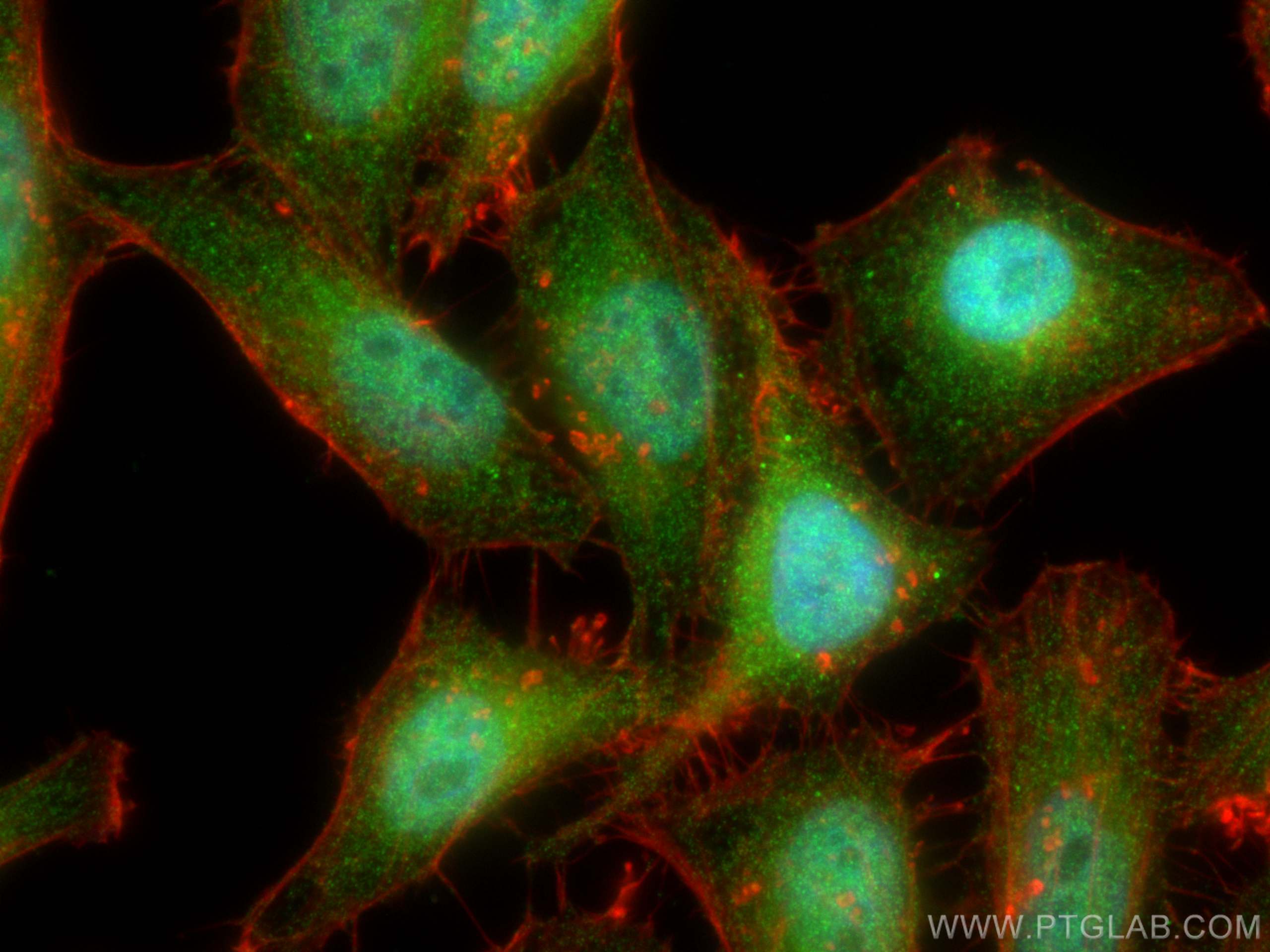 IF Staining of HepG2 using 21854-1-AP