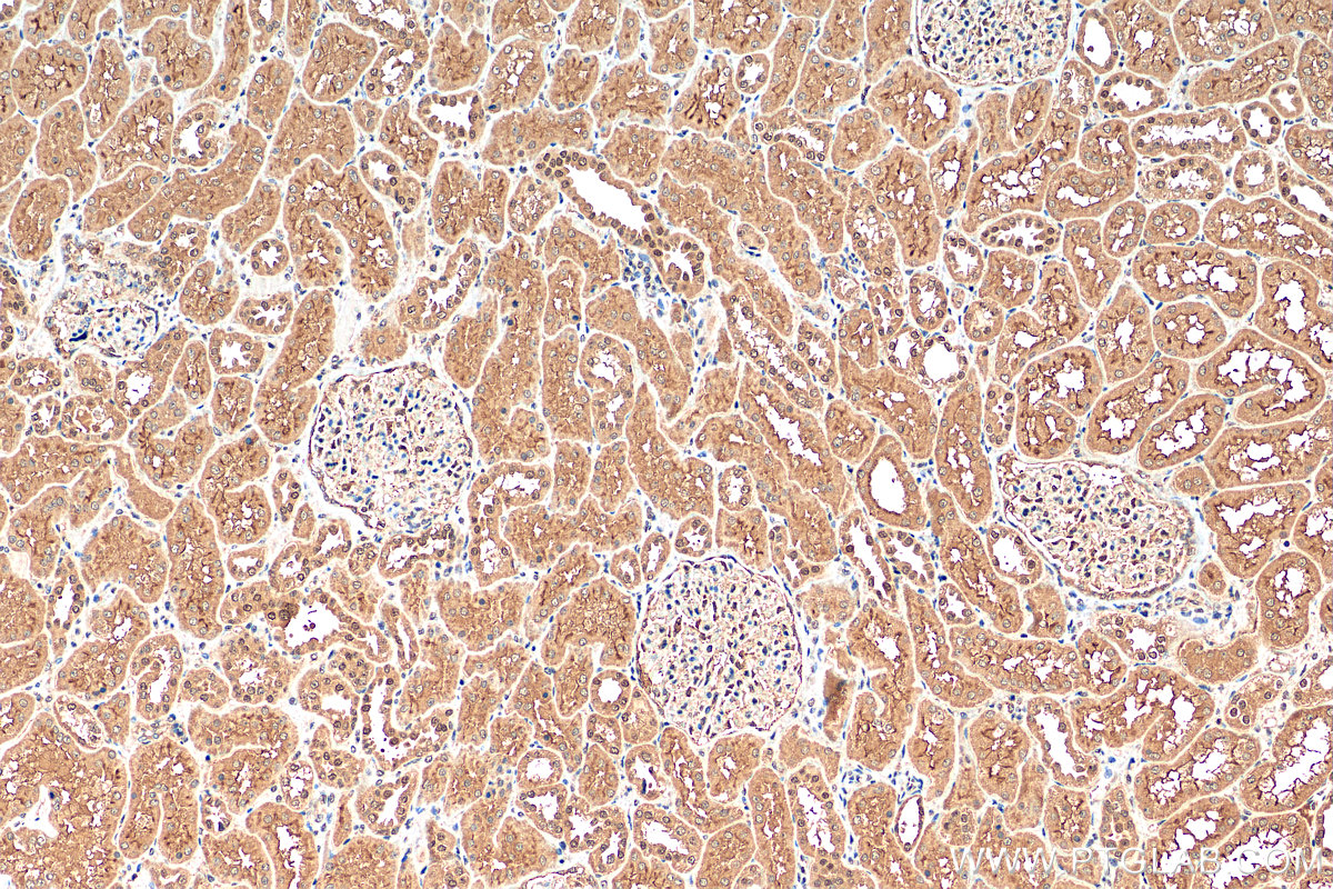 IHC staining of human kidney using 21854-1-AP
