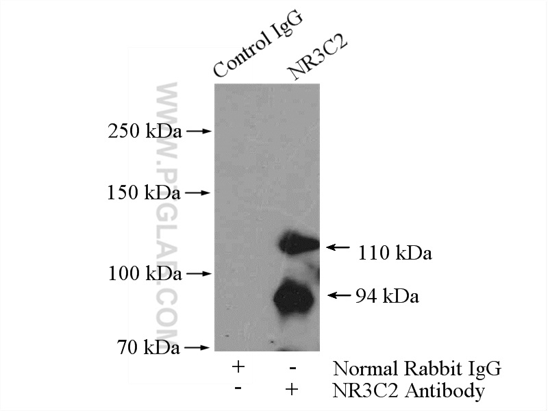 IP experiment of HEK-293 using 21854-1-AP