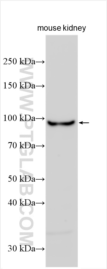 WB analysis of mouse kidney using 21854-1-AP