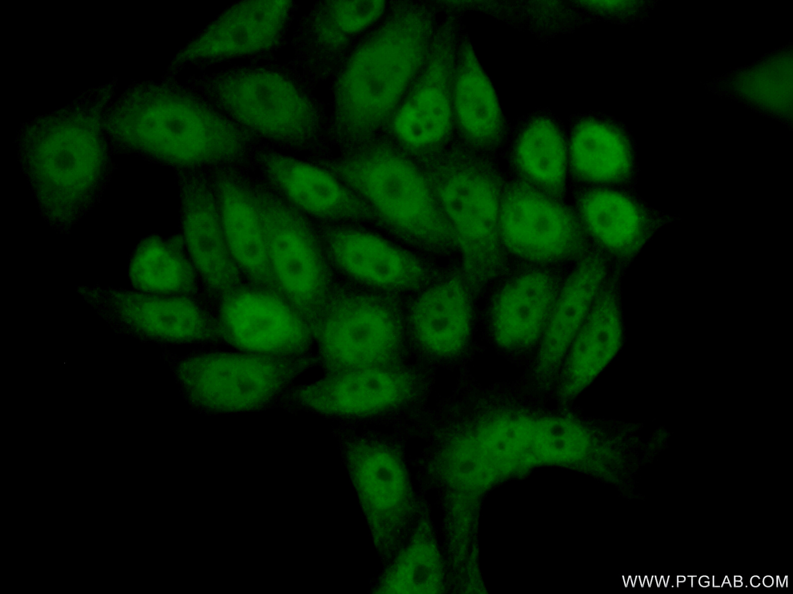 IF Staining of PC-3 using 12235-1-AP