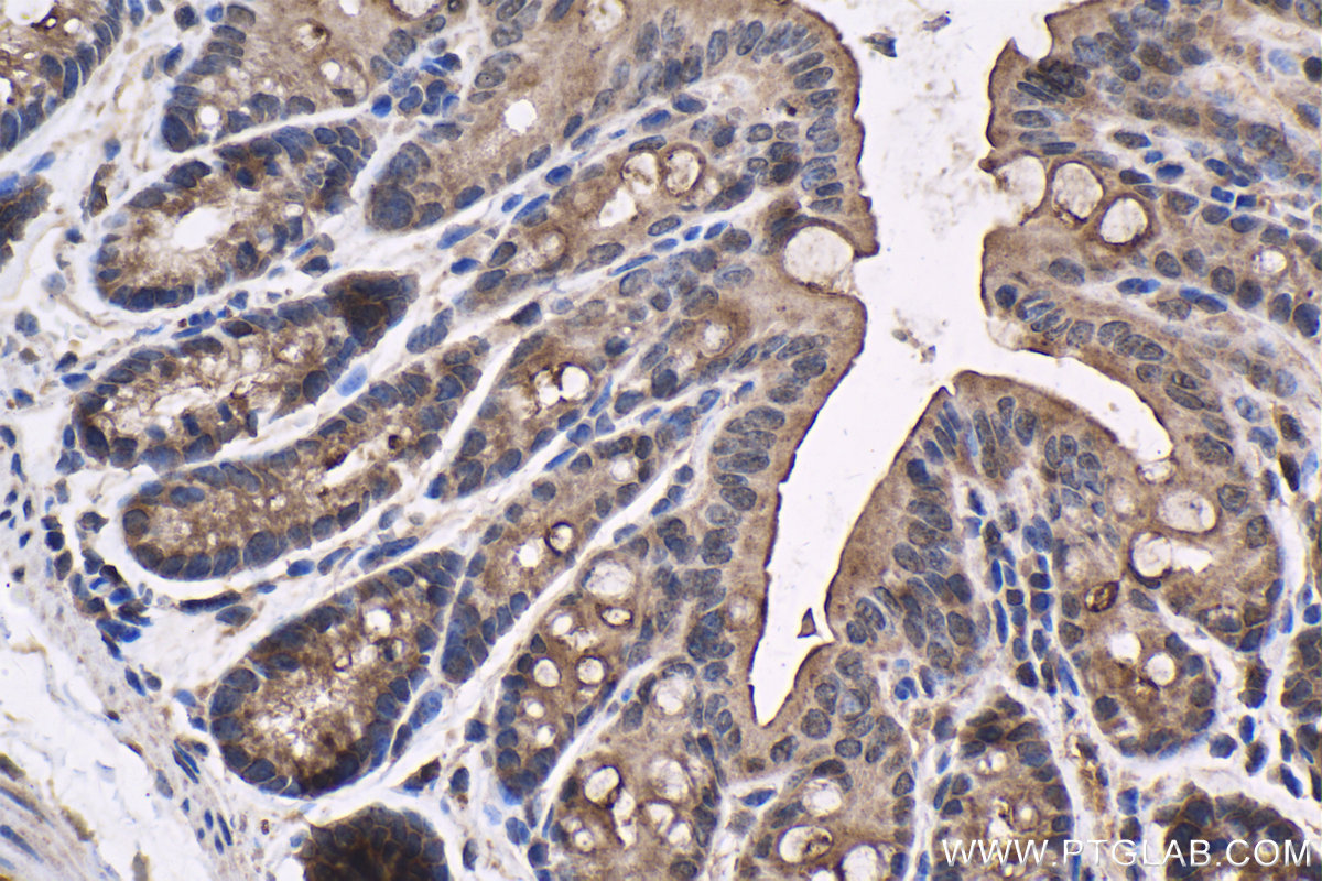 IHC staining of mouse colon using 12235-1-AP