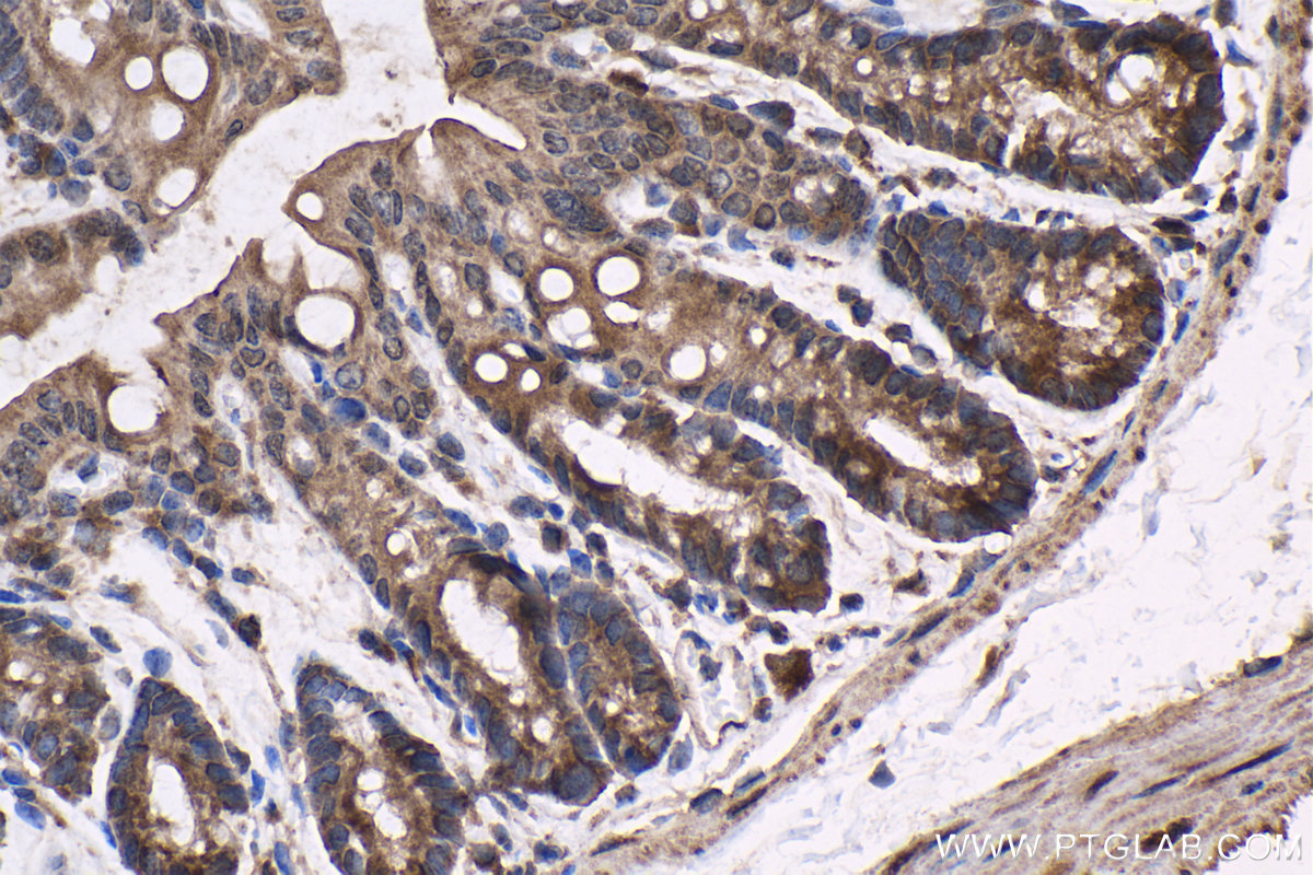 IHC staining of mouse colon using 25851-1-AP