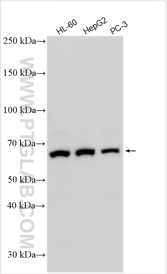 WB analysis using 25851-1-AP