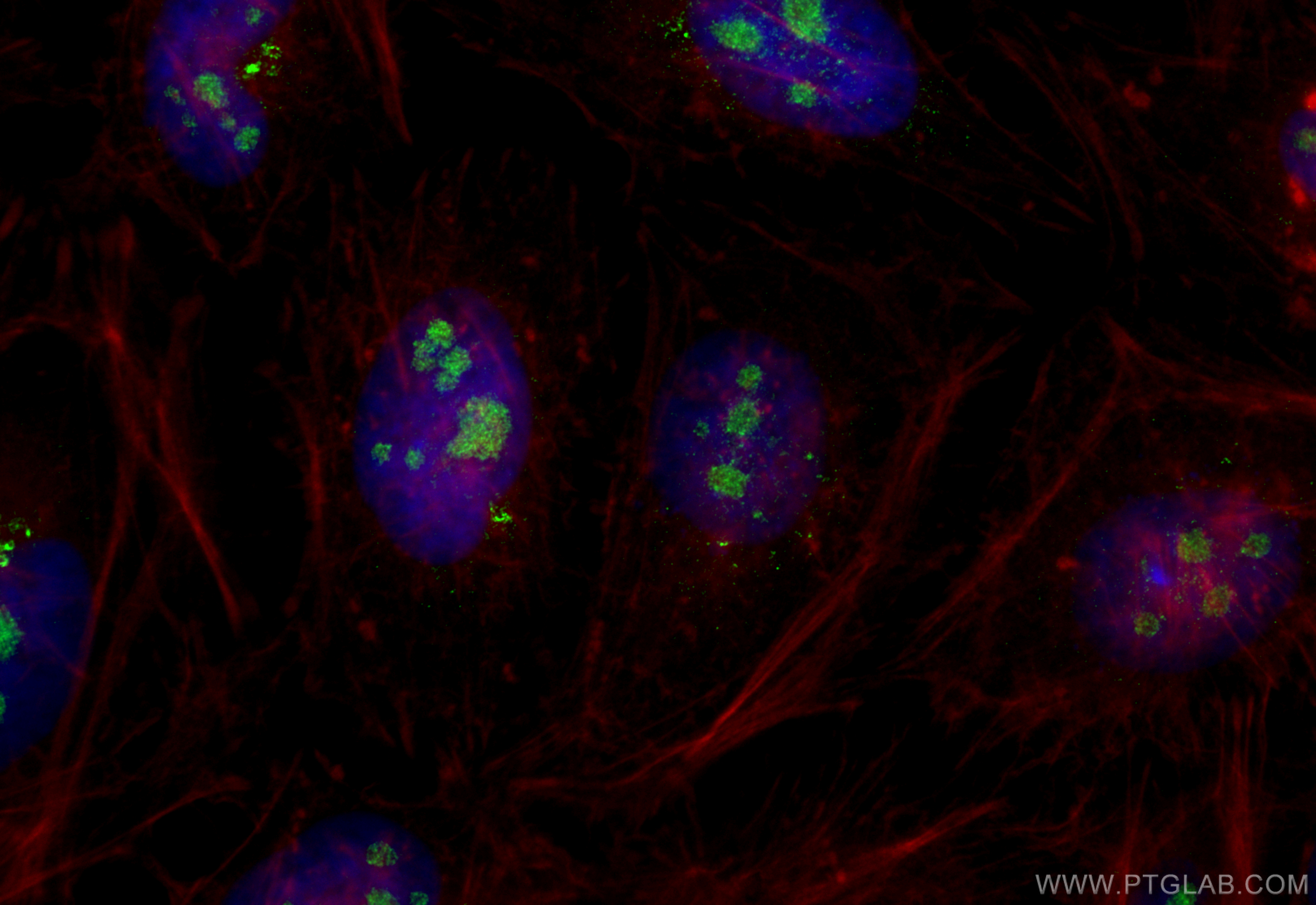 IF Staining of HeLa using 10975-2-AP