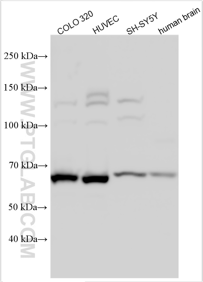 WB analysis using 10975-2-AP