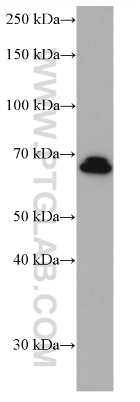 NR4A2