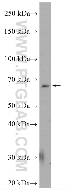 NR4A3