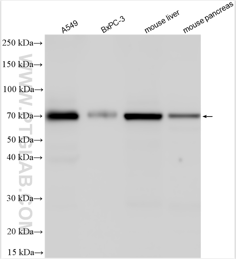 WB analysis using 22460-1-AP