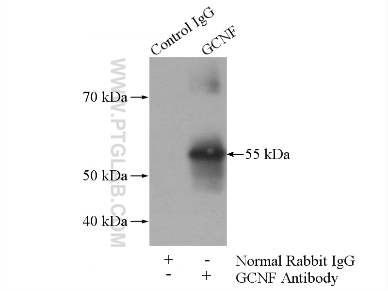 IP experiment of mouse testis using 12712-1-AP