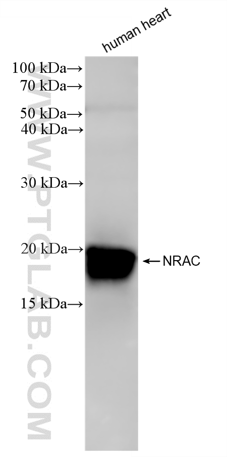 WB analysis of human heart using 87528-1-RR (same clone as 87528-1-PBS)