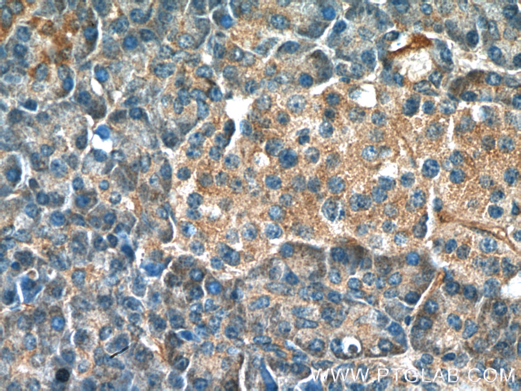 IHC staining of human pancreas using 10724-1-AP