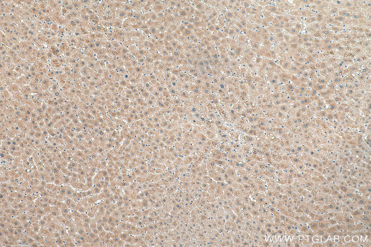 IHC staining of human liver using 24858-1-AP