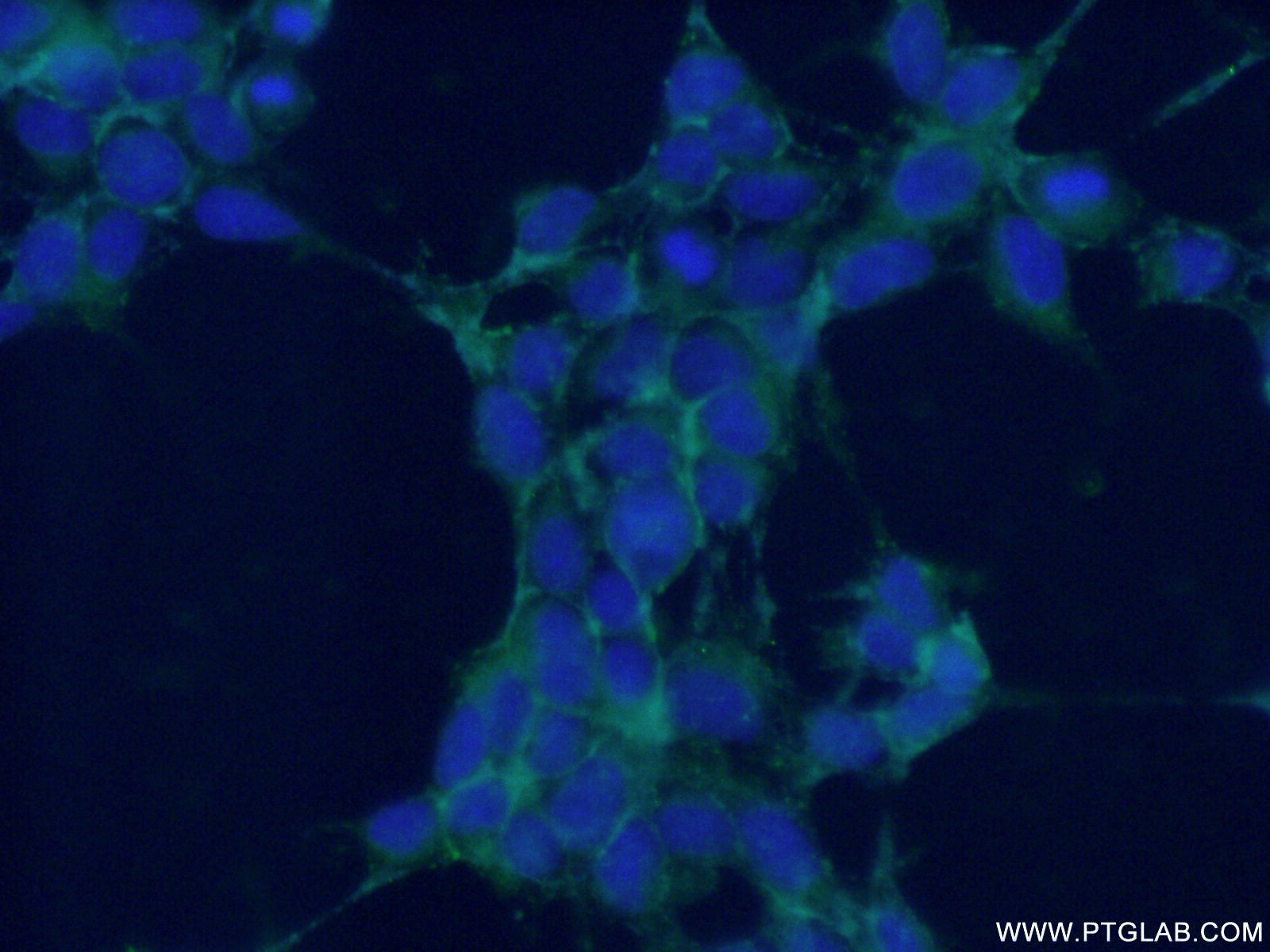 IF Staining of HEK-293 using 21608-1-AP