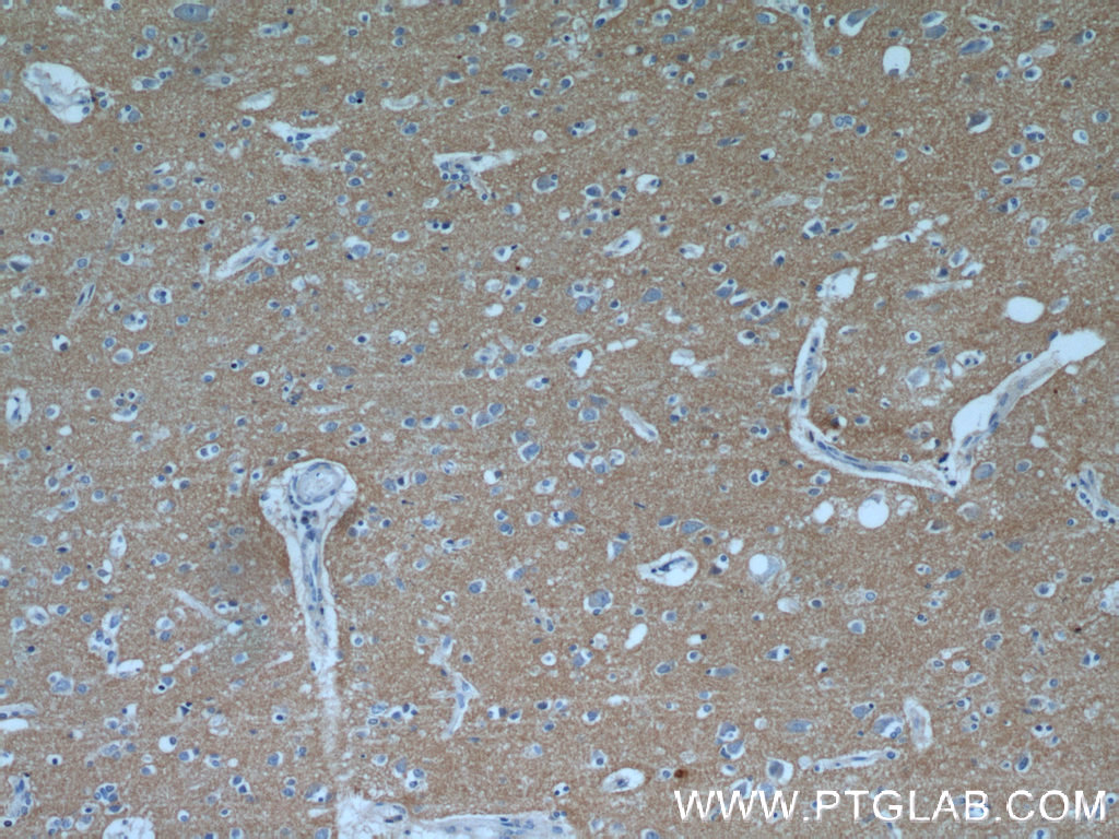 IHC staining of human brain using 21608-1-AP