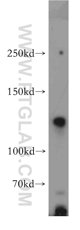 NRCAM Polyclonal antibody