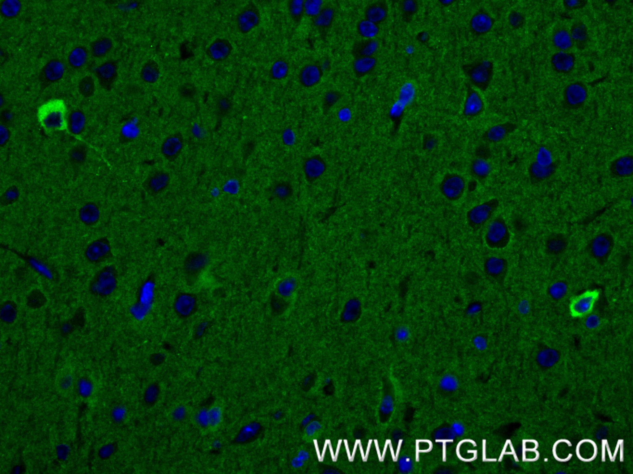 Immunofluorescent analysis of (4% PFA) fixed paraffin-embedded mouse brain tissue using NRCAM antibody (<a class='green' href='/productredirect?CatalogNo=84690-1-RR' target='_blank'>84690-1-RR</a>, Clone: 241862G1 ) at dilution of 1:200 and CoraLite®488-Conjugated Goat Anti-Rabbit IgG(H+L) (<a class='green' href='/productredirect?CatalogNo=SA00013-2' target='_blank'>SA00013-2</a>). Heat mediated antigen retrieval with Tris-EDTA buffer (pH 9.0). This data was developed using the same antibody clone with 84690-1-PBS in a different storage buffer formulation. IF Staining of mouse brain using 84690-1-RR (same clone as 84690-1-PBS)