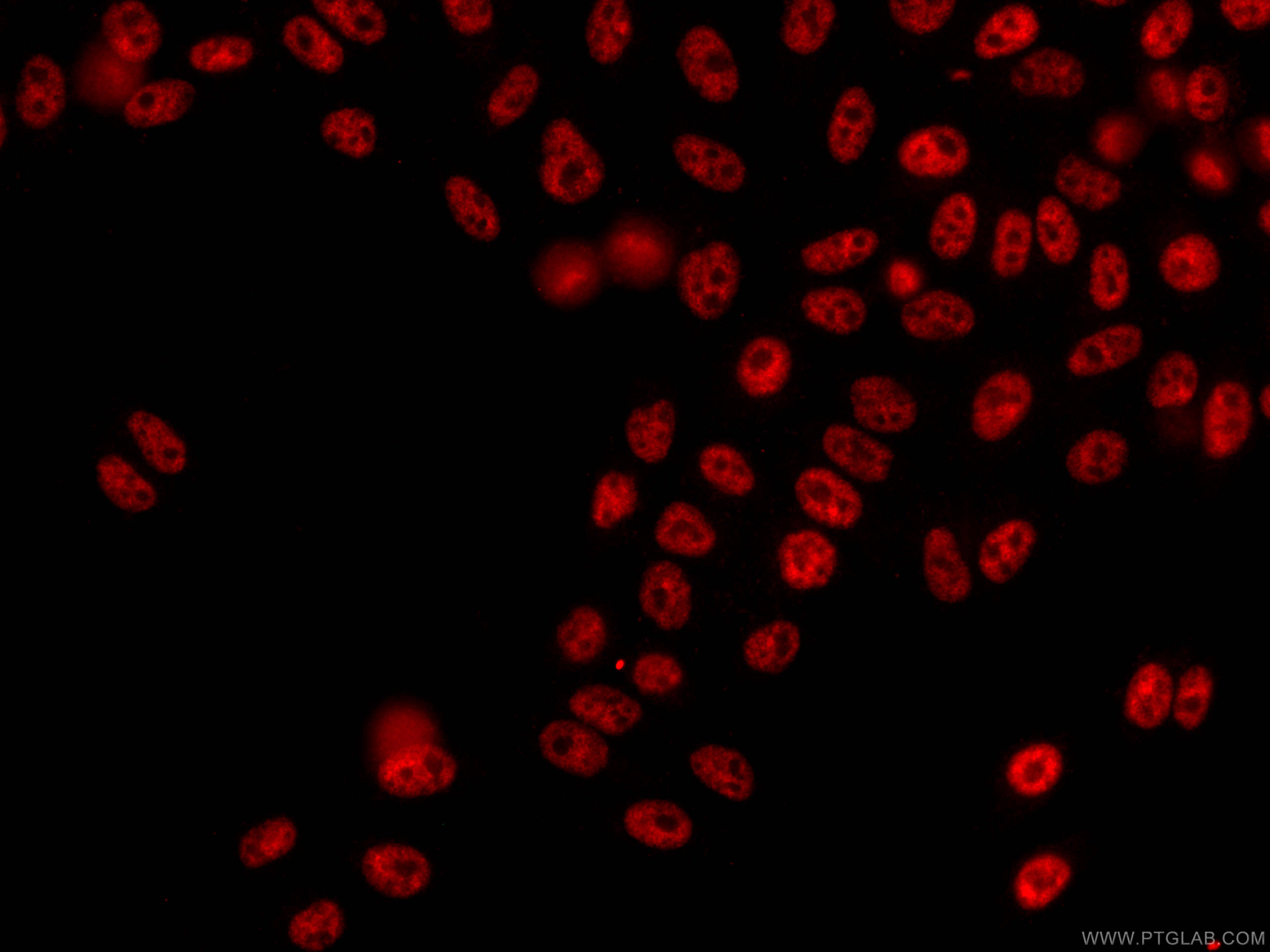 IF Staining of HepG2 using CL594-66832