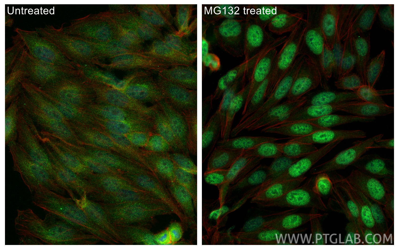 IF Staining of HepG2 using 66504-1-Ig IF Staining of HepG2 using 66504-1-Ig