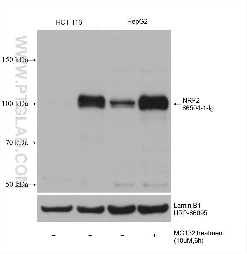 Various lysates were subjected to SDS PAGE followed by western blot with 66504-1-Ig (NRF2, NFE2L2 antibody) at dilution of 1:10000 incubated at room temperature for 1.5 hours. WB analysis using 66504-1-Ig