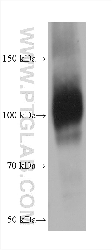 MG132 treated NIH/3T3 cells were subjected to SDS PAGE followed by western blot with 66504-1-Ig (NRF2, NFE2L2 antibody) at dilution of 1:10000 incubated at room temperature for 1.5 hours. WB analysis of NIH/3T3 using 66504-1-Ig