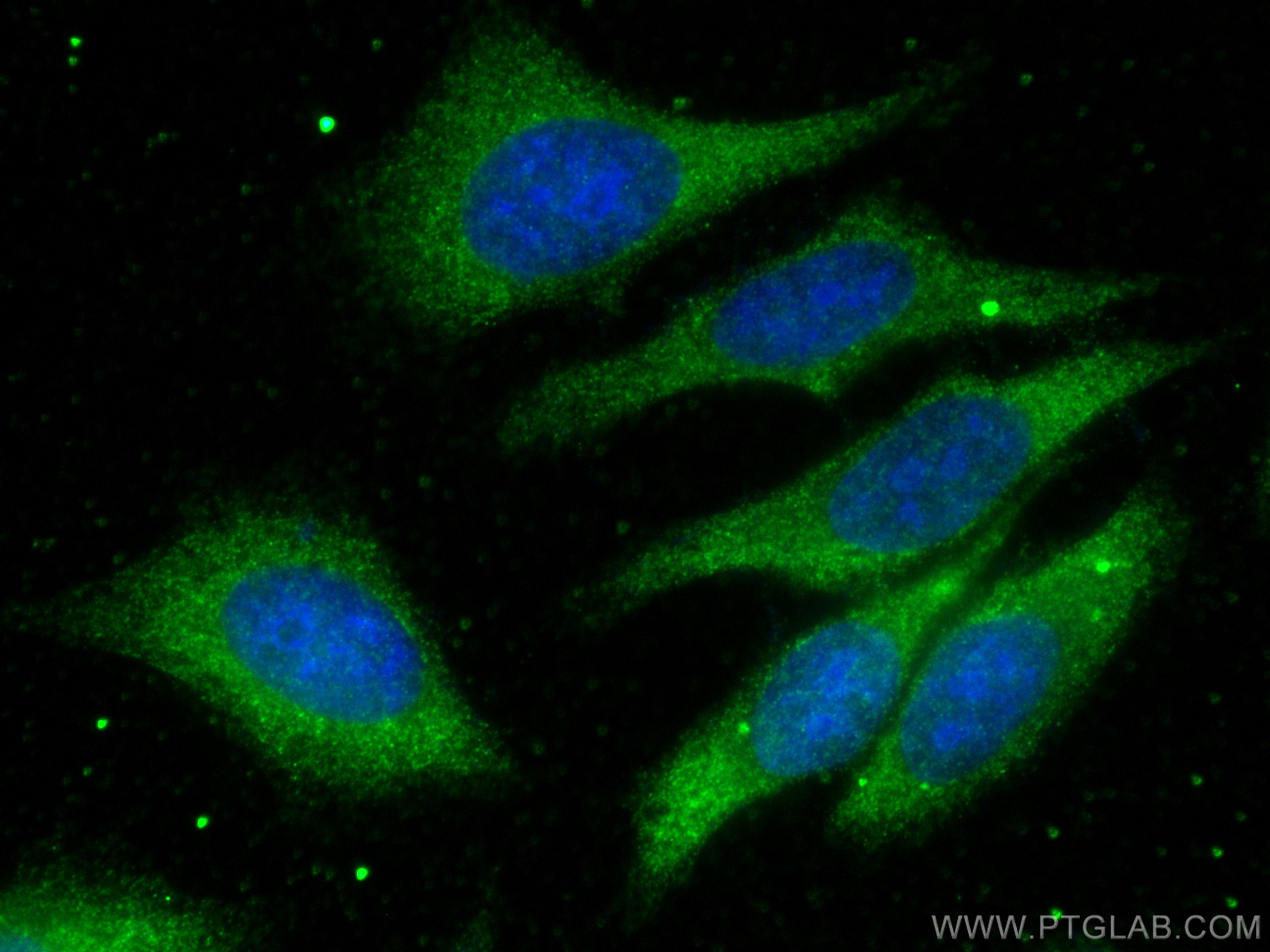 IF Staining of HepG2 using 80593-1-RR