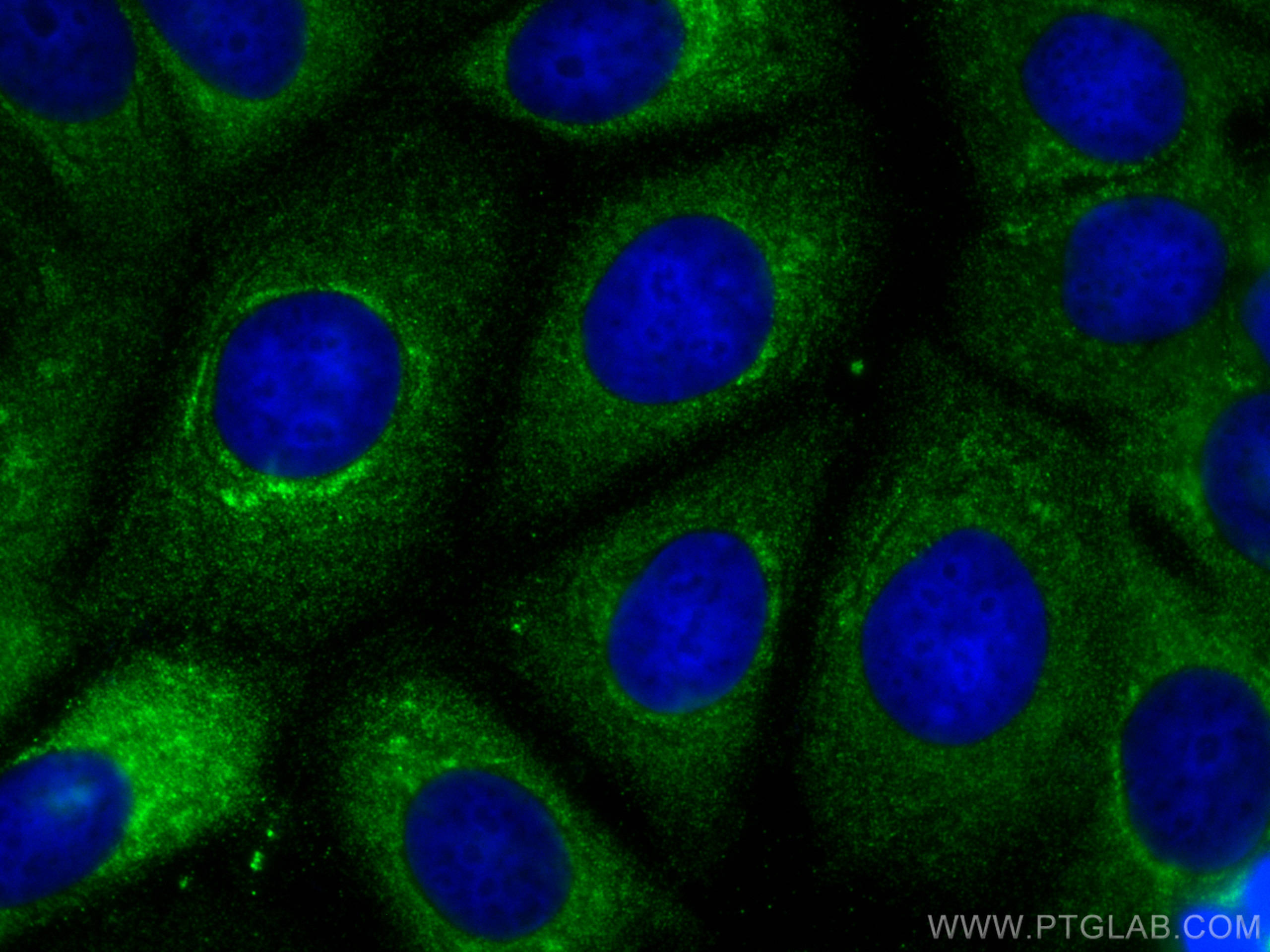 IF Staining of MCF-7 using 10527-1-AP
