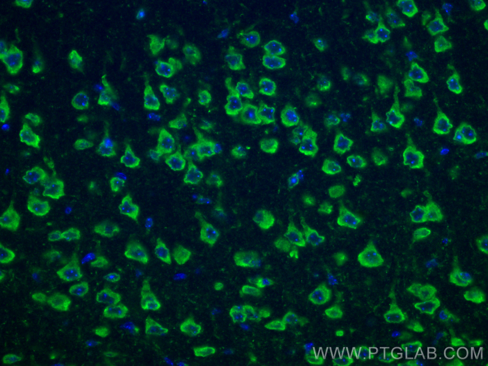 IF Staining of mouse brain using 10527-1-AP
